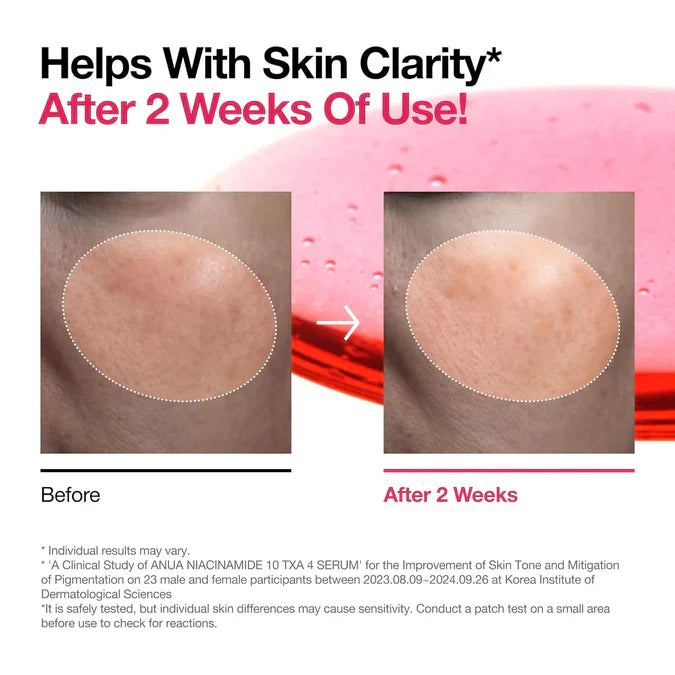 ANUA NIACINAMIDE 10% + TXA 4% DARK SPOT CORRECTING SERUM